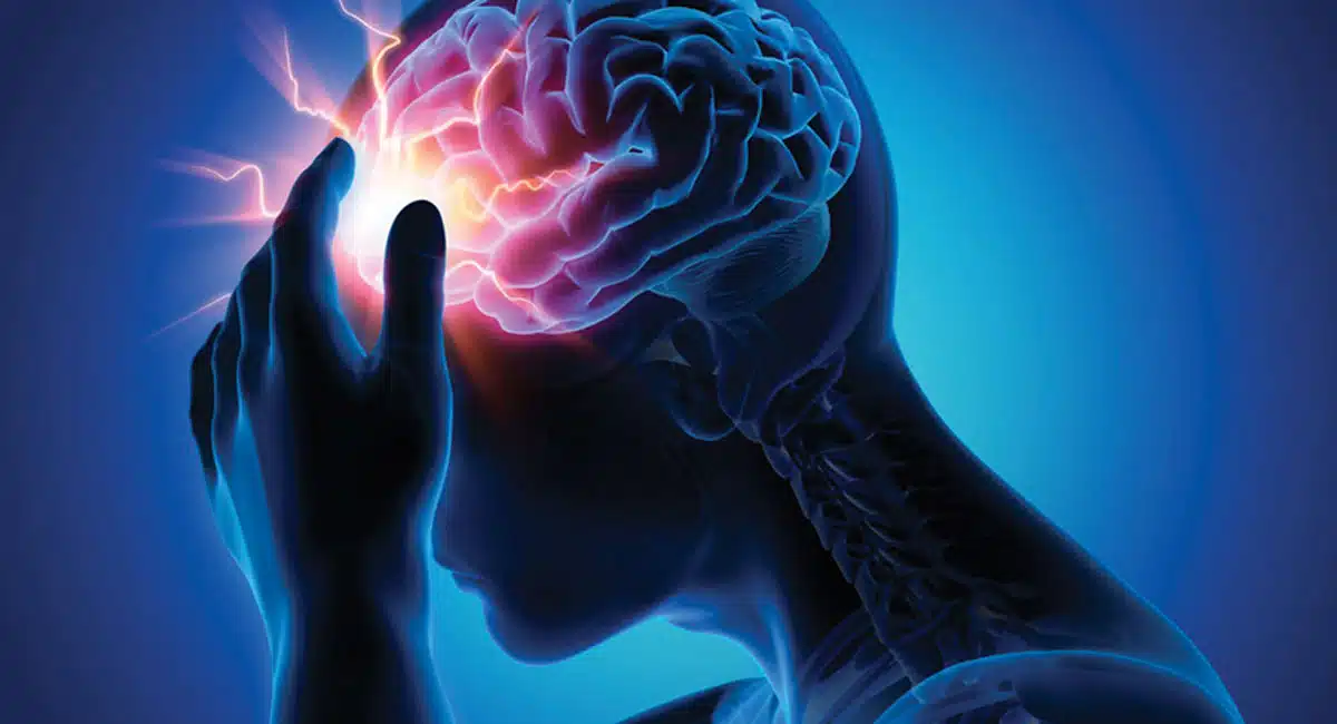 Brain Stroke Treatment,Hemorrhagic Stroke