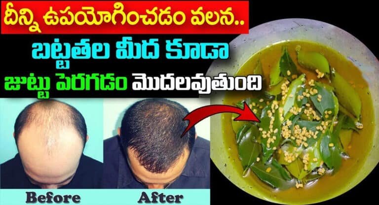Hair Growth : దీన్ని ఉపయోగించడం వలన బట్టతల మీద కూడా జుట్టు పెరగడం మొదలవుతుంది…!