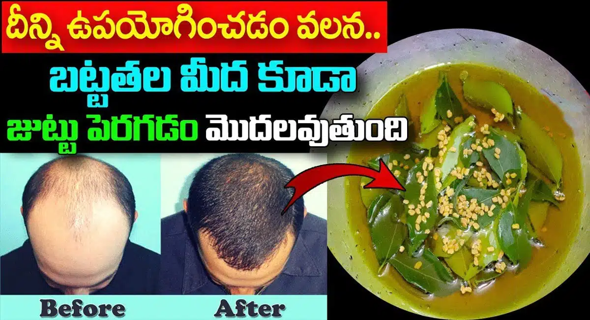 Hair Growth : దీన్ని ఉపయోగించడం వలన బట్టతల మీద కూడా జుట్టు పెరగడం మొదలవుతుంది...!