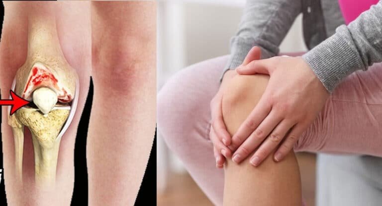Joint Pains : 10 రోజులు తాగితే చాలు.. మోకాళ్ల నొప్పులకు చెక్ పెట్టవచ్చు…!