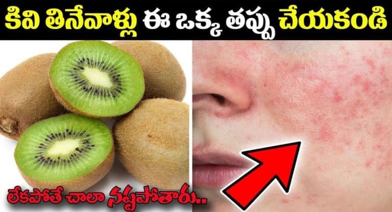 Kiwi Fruits : కివి తినేవాళ్లు ఈ ఒక్క తప్పు చేయకండి… లేకపోతే చాలా నష్టపోతారు…!