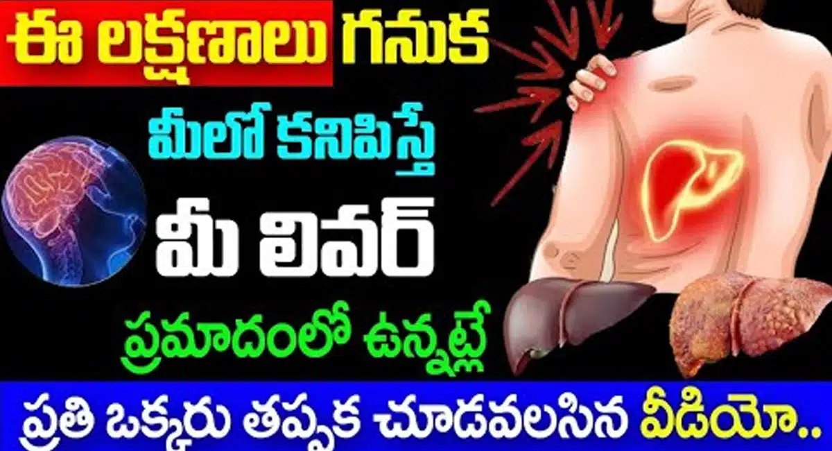 Liver Failure : ఈ లక్షణాలు గనుక మీలో కనిపిస్తే మీ లివర్ ప్రమాదంలో ఉన్నట్లే...!