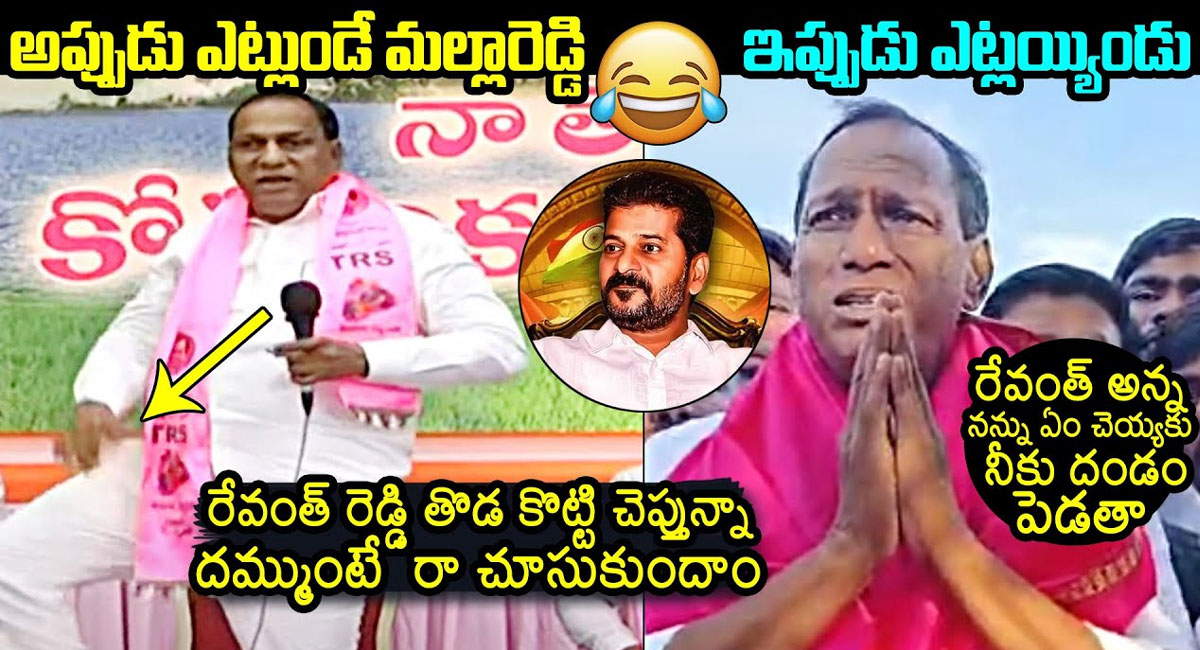 Malla Reddy : అప్పుడు రేవంత్ రెడ్డి పై ఘాటు వ్యాఖ్యలు చేసిన మల్లారెడ్డి.. ఇప్పుడు ఎలా మాట్లాడారో చూడండి..!