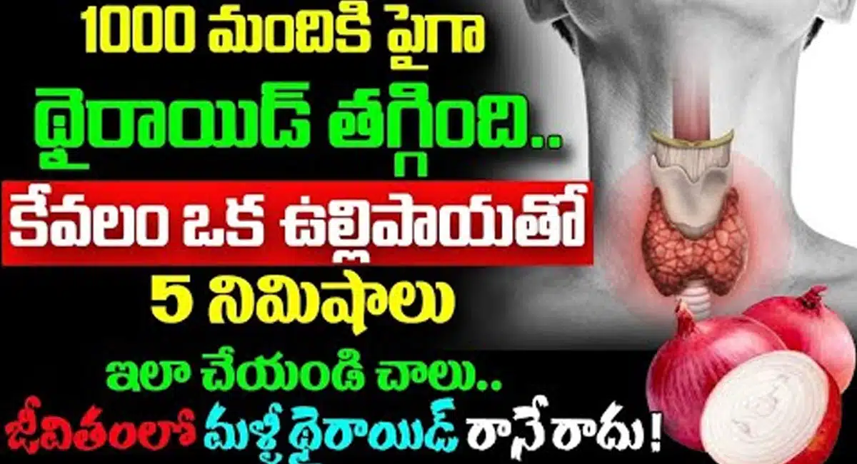 Thyroid : కేవలం ఒక్క ఉల్లిపాయతో 5 నిమిషాలు ఇలా చేయండి చాలు... జీవితంలో మళ్ళీ థైరాయిడ్ రానే రాదు...!