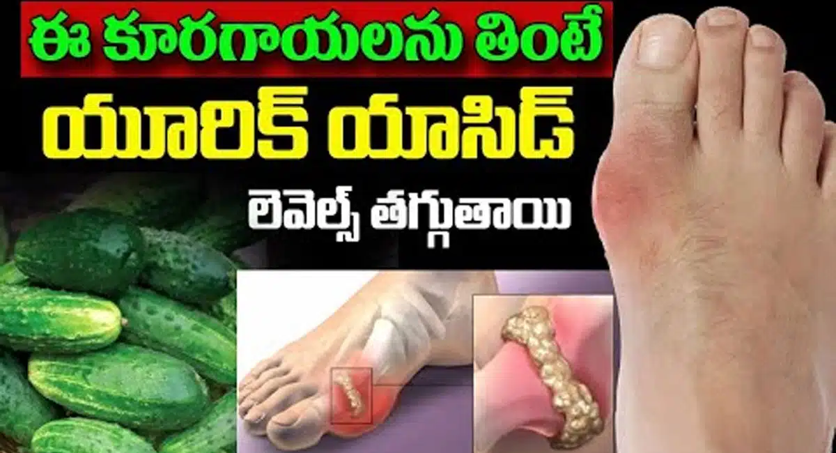 Uric Acid : ఈ కూరగాయలు తింటే యూరిక్ యాసిడ్ లెవెల్స్ తగ్గుతాయి...!