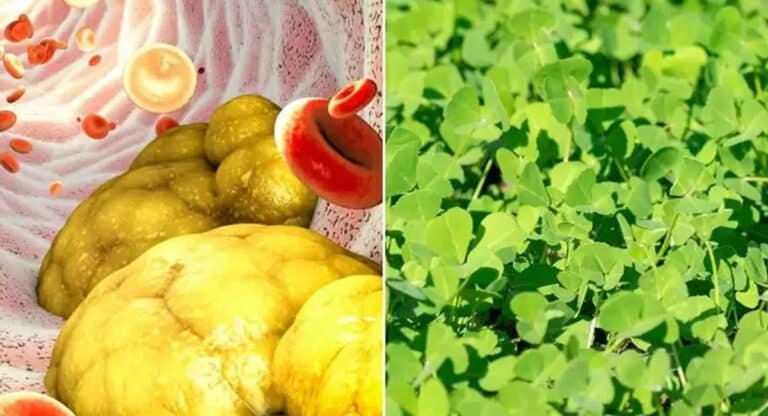 Weight Loss : ఈ ఆకుల టీతో కొలెస్ట్రాల్ కు ఈజీగా కరిగించుకోవచ్చు…!