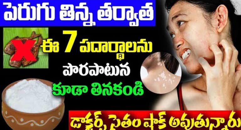 Side Effects : పెరుగుతున్న తర్వాత ఈ 7 పదార్థాలను పొరపాటున తిన్నారంటే… డేంజర్ లో పడక తప్పదు…!