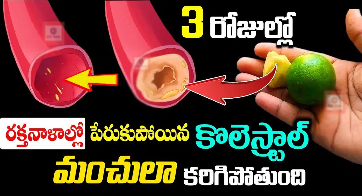 Cholesterol : 3 రోజులలో రక్తనాళాల్లో పేరుకుపోయిన కొలెస్ట్రాల్ మంచులా కరుగుతుంది...!