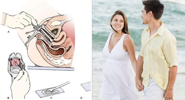 Health Problems : పెళ్లయిన తర్వాత ప్రతి మహిళ ఈ పరీక్ష ఎందుకు చేయించుకోవాలో తెలుసా.?