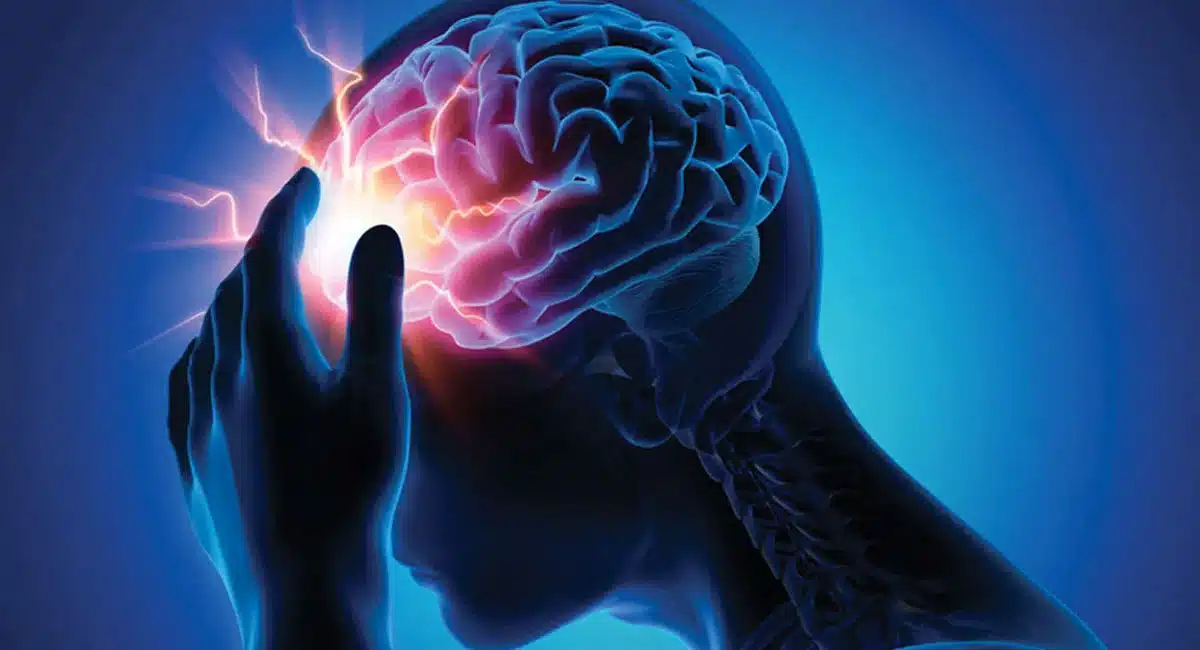 Brain Stroke : 7 రోజుల ముందే బ్రెయిన్ స్ట్రోక్ లక్షణాలను కనిపెట్టవచ్చు... ఎలాగో తెలుసా.?