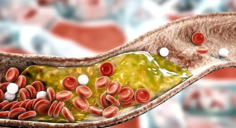 Bad Cholesterol : చెడు కొలెస్ట్రాల్ పెరగడానికి కారణం ఏంటి…?దీనివలన ఎలాంటి సమస్యలు వస్తాయంటే..?