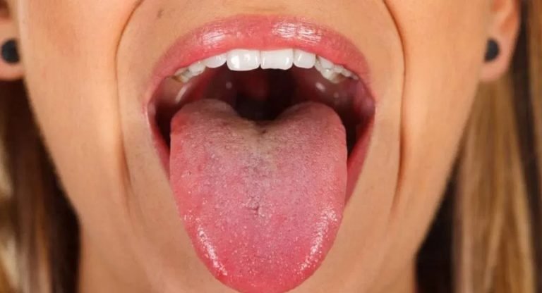 Throat : గొంతు నొప్పి, మింగటం లో ఇబ్బందా… అయితే ఈ ప్రాణాంతక వ్యాధే కారణం…!