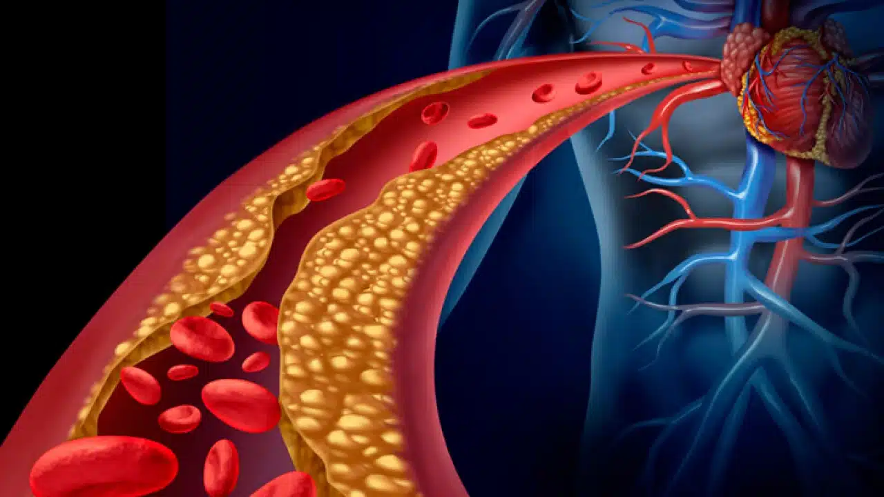 Cholesterol : ప్రతి రోజు 30 నిమిషాల పాటు ఇలా చేస్తే... కొలెస్ట్రాల్ ఈజీగా నియంత్రించవచ్చు...!