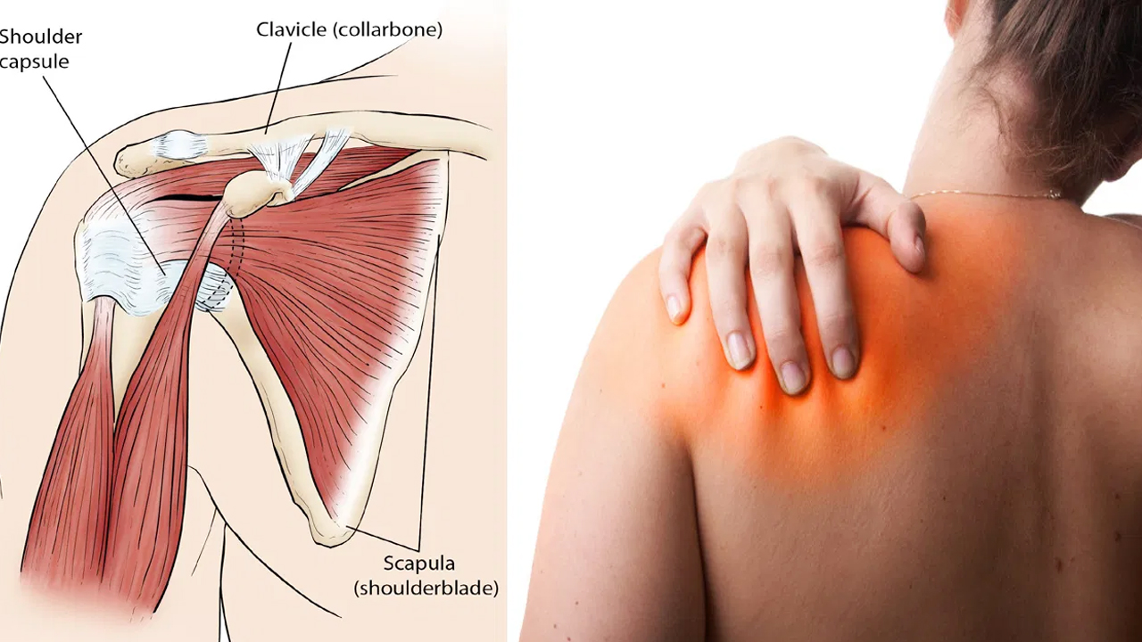 Shoulder Pain : పరీతమైన భుజం నొప్పి వస్తుందా… దీనిని ఎలా నివారించాలంటే…