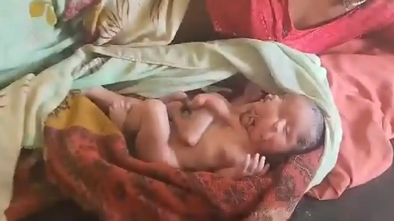 Viral Video : వింత శిశువు.. రెండు ముఖాలు, నాలుగు చేతులు, నాలుగు కాళ్లతో జ‌న్మించి ఆపై..!