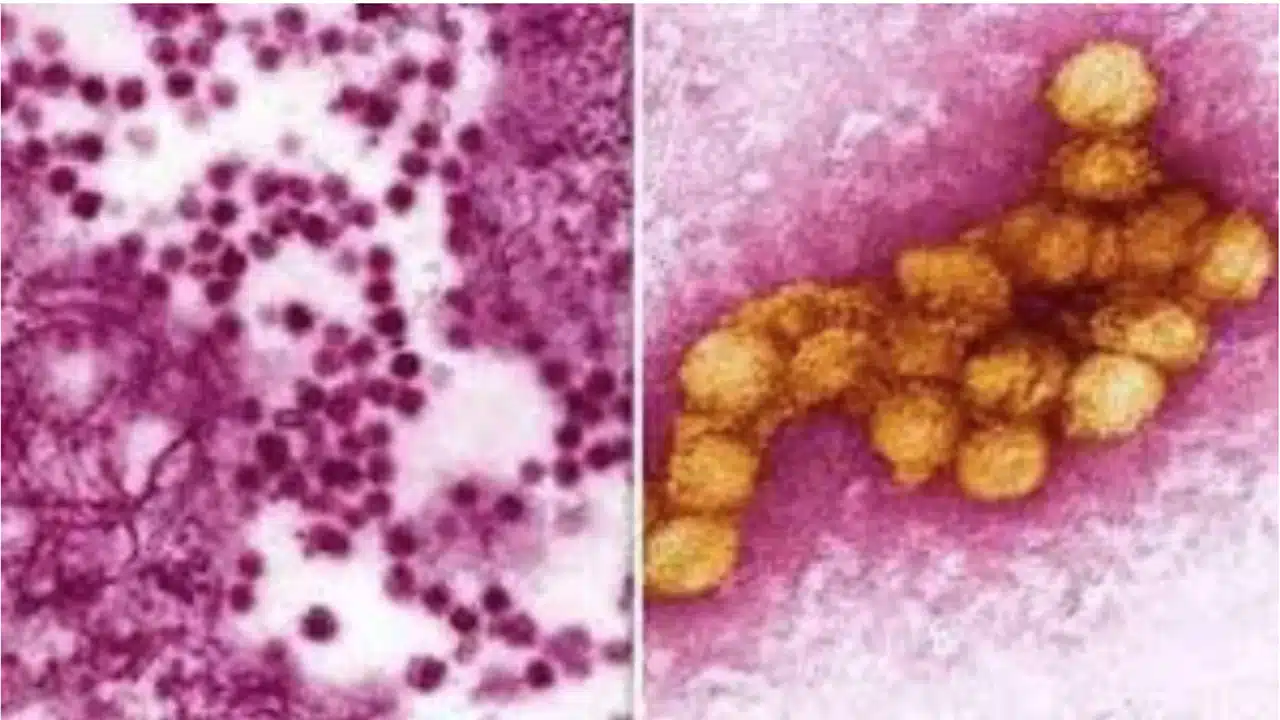 West Nile Virus : మానవులపై దాడి చేస్తున్న వేస్ట్ నైల్ వైరస్... ఈ వ్యాధి తీవ్రత లక్షణాలు ఎలా ఉంటాయంటే..!