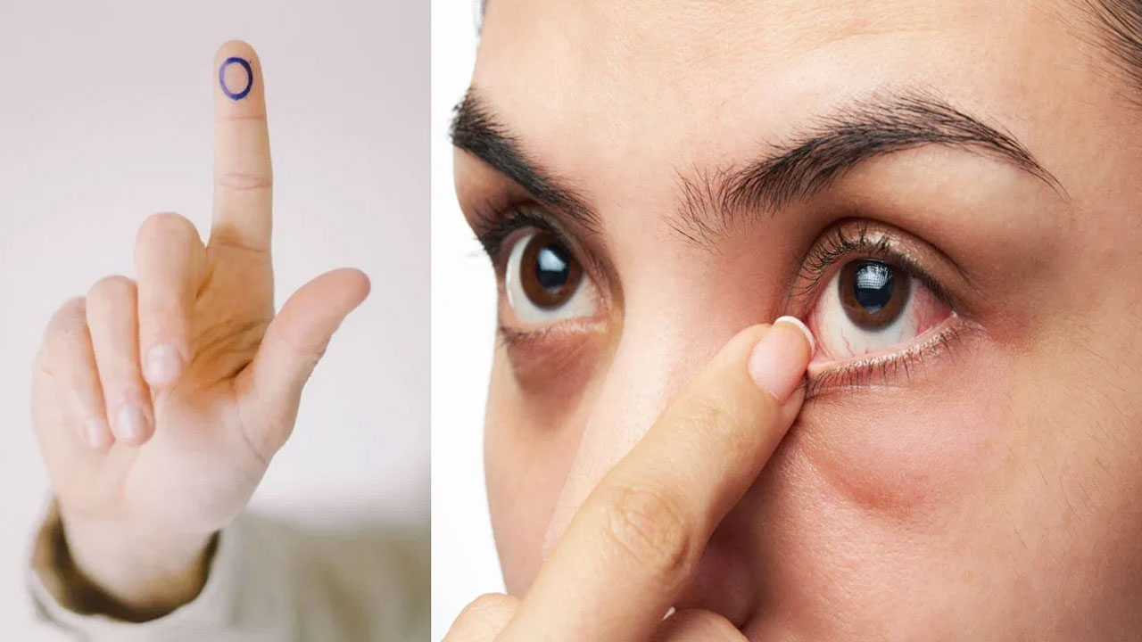 Diabetes Eyes : కంటి సమస్యల ద్వారా మధుమేహం లక్షణాలను ఎలా గుర్తించాలో తెలుసా…!!