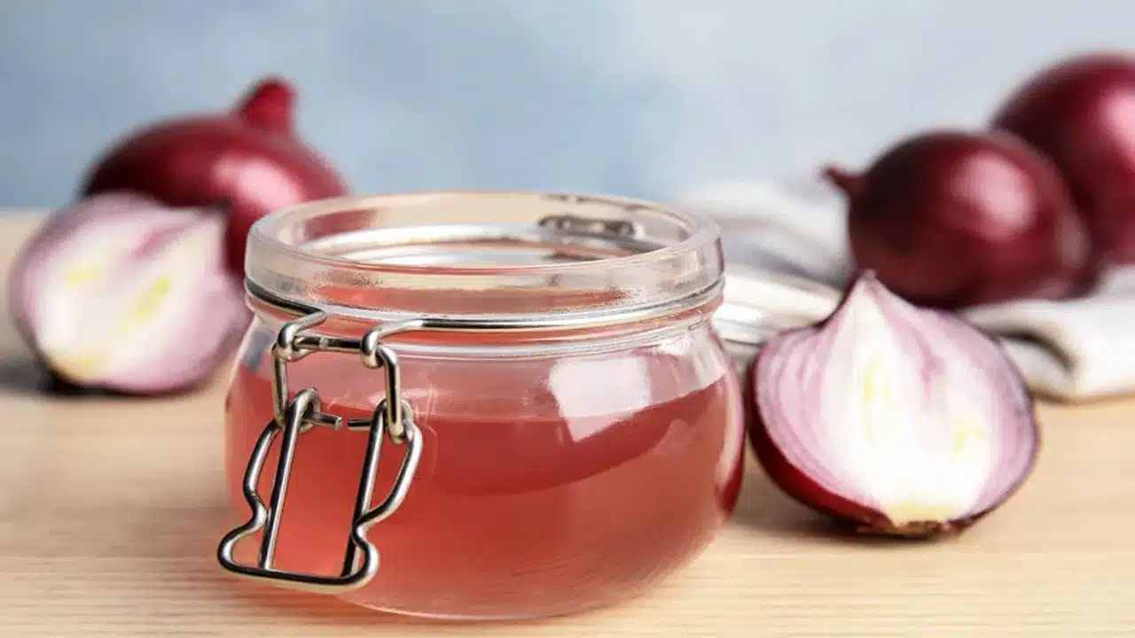 Onion : ఉల్లిపాయతో మొటిమలు, నల్ల మచ్చలకు ఈజీగా చెక్ పెట్టొచ్చు తెలుసా...!