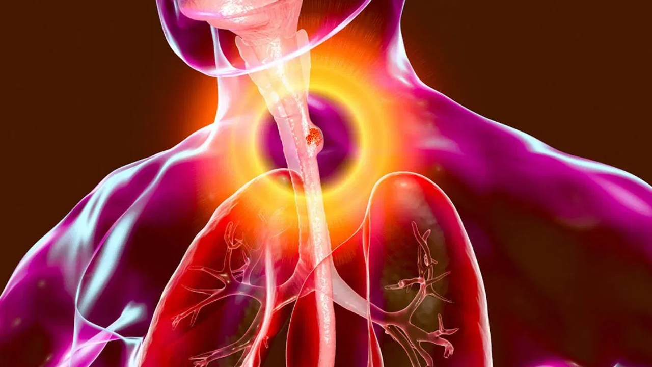 Throat Pain : ప్రతిరోజు జలుబు, గొంతు నొప్పి సమస్యతో బాధపడుతున్నారా… జాగ్రత్త… ఇది క్యాన్సర్ కు సంకేతం కావచ్చు…!