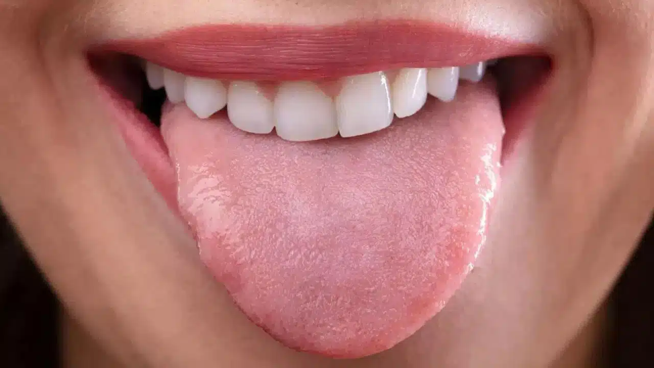 Tongue : మీ నాలుకను బట్టి మీ ఆరోగ్యం ఎలా ఉందో ఈజీగా చెప్పొచ్చు తెలుసా...!