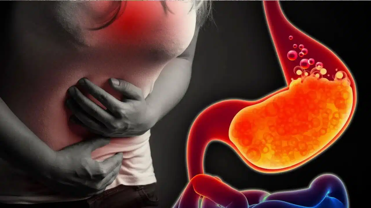 Acidity : అసిడిటీ సమస్యకు చేక్ పెట్టాలంటే... ఈ నాలుగు ఆహారాలు బెస్ట్...??