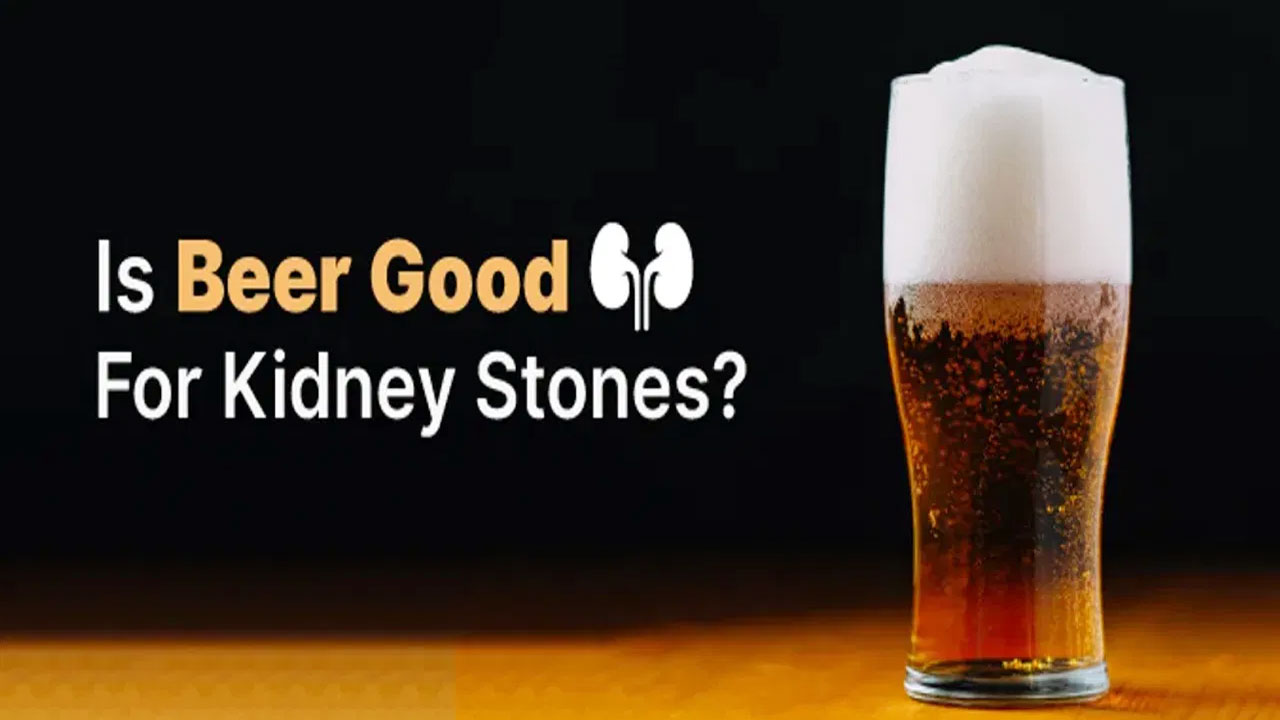 Beer kidney Stones : బీర్లు తాగే ప్రతి ఒక్కరూ తెలుసుకోవలసిన విషయం… కిడ్నీలో రాళ్లు కరుగుతాయా…?