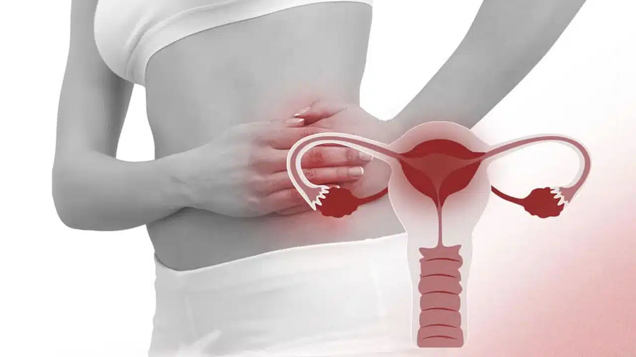 Womens : మహిళలకు ఆ సమయంలో భరించలేని కడుపునొప్పి వస్తుందా... అయితే తస్మాత్ జాగ్రత్త... ఈ వ్యాధి ఉండవచ్చు...?