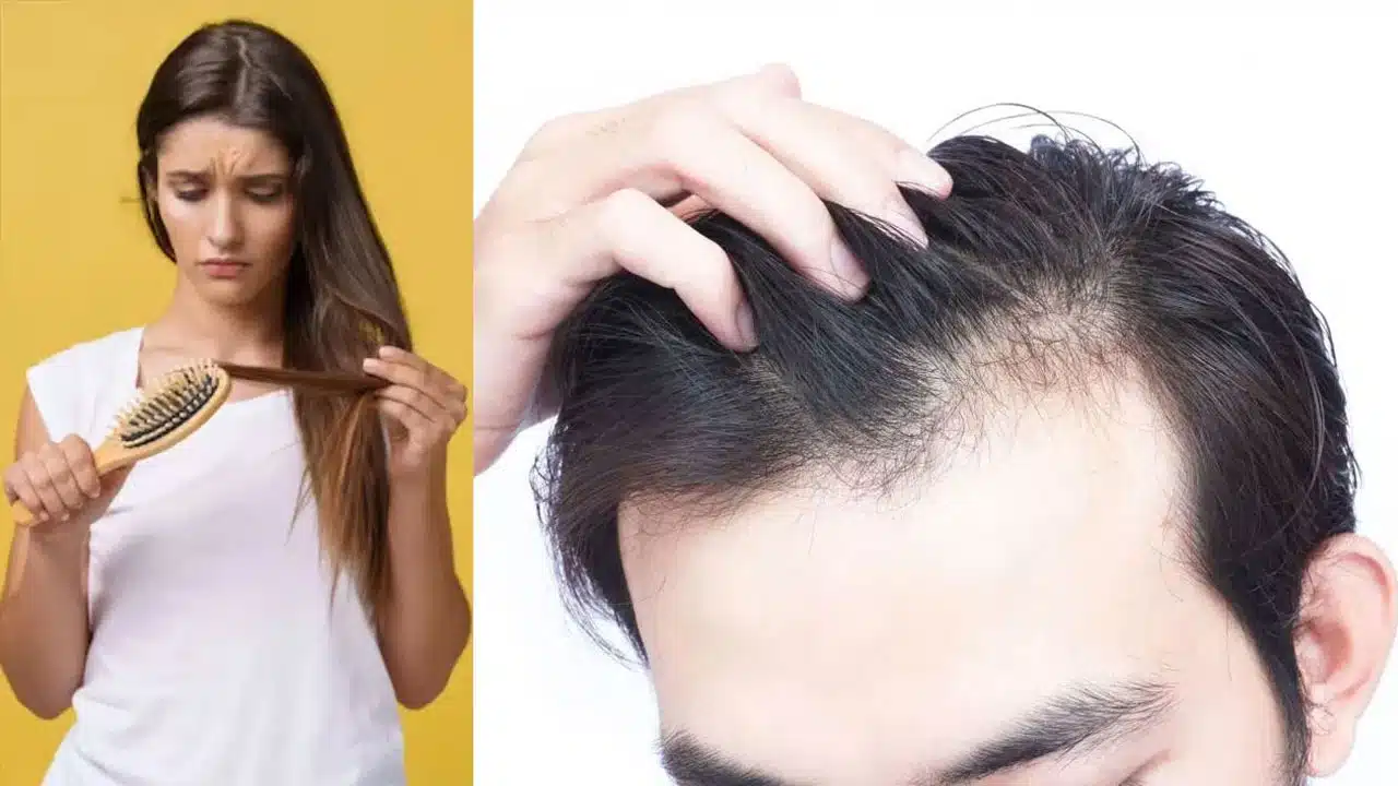 Hair Fall : జుట్టు రాలే సమస్య మీకుందా.. ఇలా చేస్తే రాలిన జుట్టు మళ్ళీ తిరిగి వస్తుంది...!