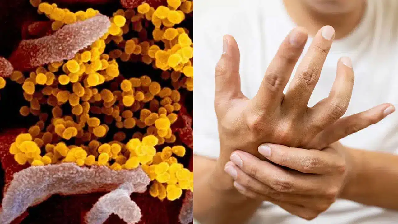  GBS Virus : ఏంట్రా బాబు ఈ వైరస్ల బాధ..మరో కొత్త వైరస్.. ఈ వ్యాధి లక్షణాలు ..ఇది ఎలా వస్తుంది...?