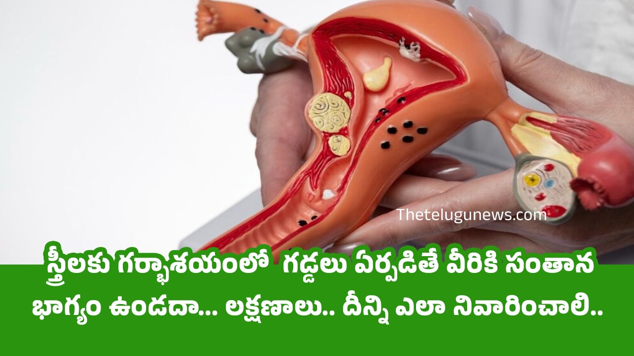 Uterine Fibroids : స్త్రీలకు గర్భాశయంలో  గడ్డలు ఏర్పడితే వీరికి సంతాన భాగ్యం ఉండదా… లక్షణాలు.. దీన్ని ఎలా నివారించాలి…?