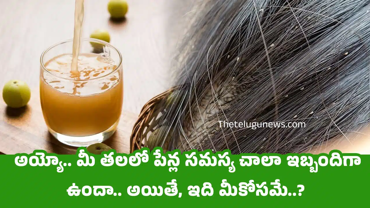 Head Lice Problem : అయ్యో.. మీ తలలో పేన్ల సమస్య చాలా ఇబ్బందిగా ఉందా.. అయితే, ఇది మీకోసమే..?