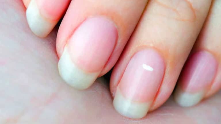 Fingernails Health : మీ గోర్లు మీ ఆరోగ్యం గురించి ఏమి చెబుతాయో తెలుసా..?