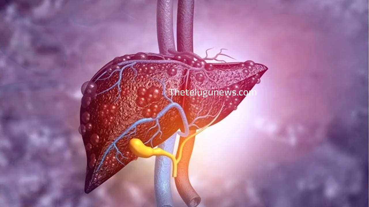 Liver Diseases : టాప్ 5 కాలేయ వ్యాధులు.. లైట్ తీసుకున్నారో పోతారు