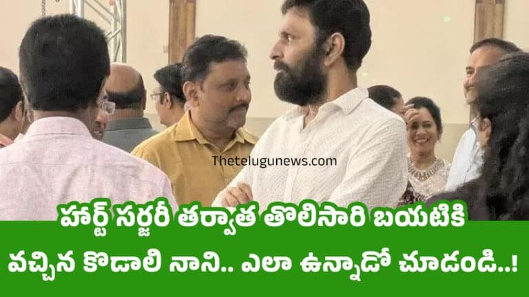 Kodali Nani : హార్ట్ సర్జరీ తర్వాత తొలిసారి బయటికి వచ్చిన కొడాలి నాని.. ఎలా ఉన్నాడో చూడండి..!