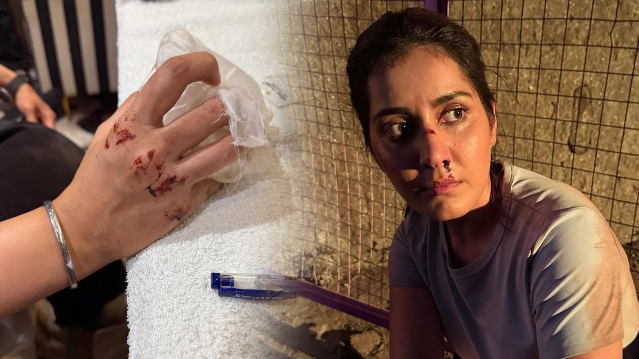 Raashi Khanna : గాయ‌ప‌డ్డ హీరోయిన్ రాశీ ఖ‌న్నా.. ఆందోళ‌నలో అభిమానులు