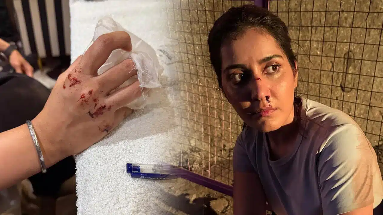 Raashi Khanna : గాయపడ్డ హీరోయిన్ రాశీ ఖన్నా.. ఆందోళనలో అభిమానులు
