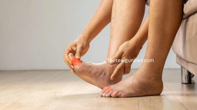 Uric Acid : యూరిక్ యాసిడ్ స్థాయిలను తగ్గించడంలో సహాయపడే ఆహార ప‌దార్థాలు