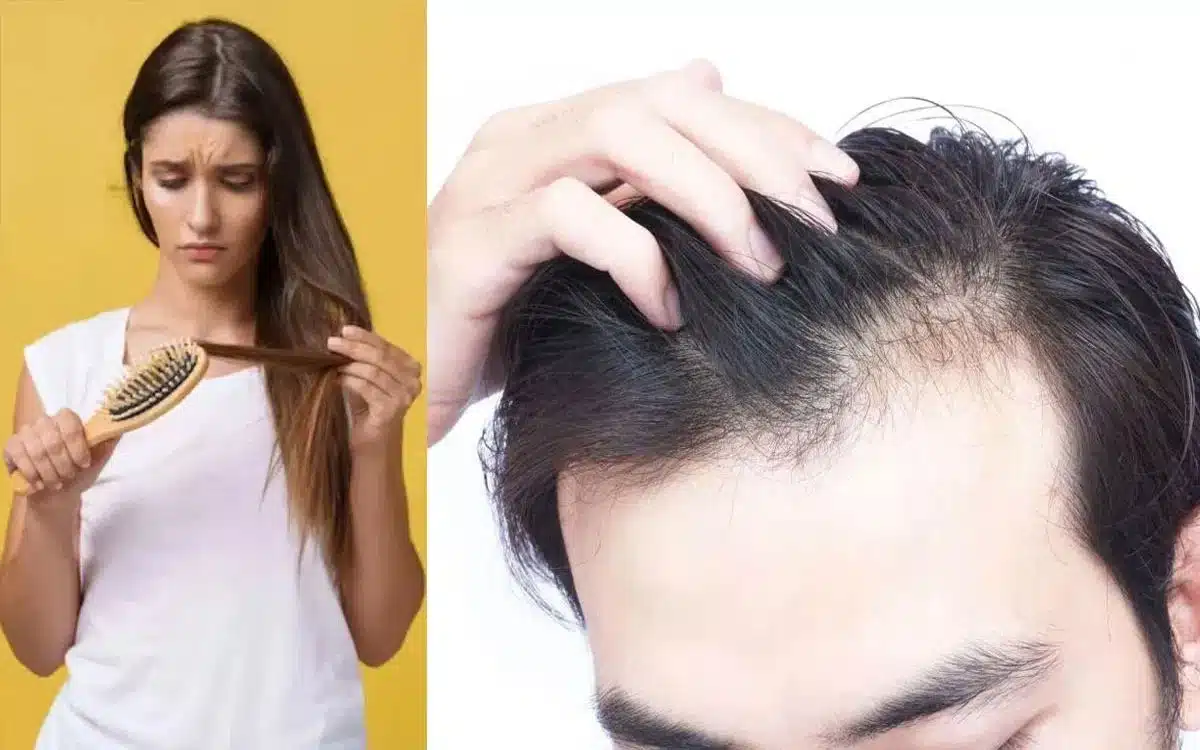 Hair Falling : మీ జుట్టు సాధారణం కంటే ఎక్కువగా రాలిపోతుందా? అయితే శ‌రీరంలోని ఈ అవ‌య‌వం డ్యామేజీ అయిన‌ట్లే