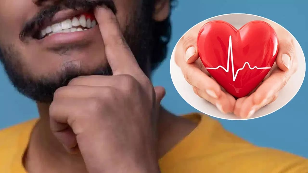 Gum Bleeding : చిగుళ్ళ నుంచి వచ్చే రక్త స్రావం… ఈ జబ్బులకి సంకేతం…?