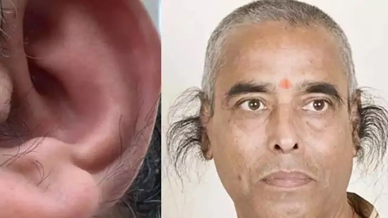 Hair On Ears : మీ చెవులపై వెంట్రుకలు ఉన్నాయా... దీని అర్థం ఏమిటో తెలుసా...?