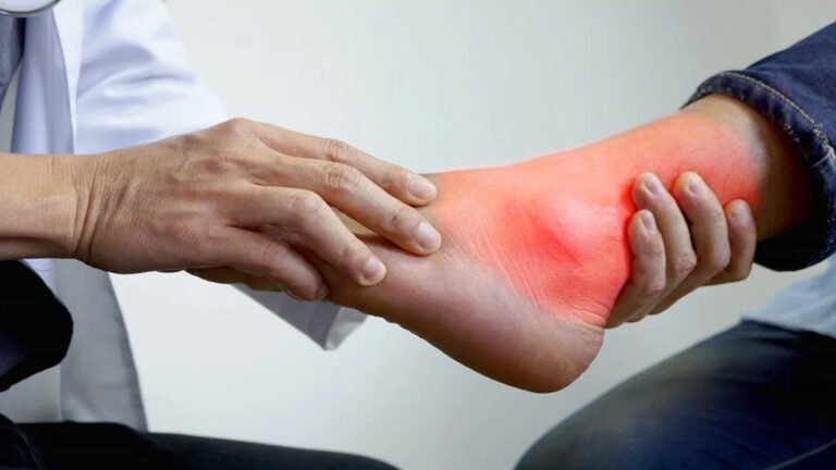 Uric Acid : యూరిక్ యాసిడ్ రాత్రి సమయంలోనే ఎక్కువగా పెరుగుతుంది,ఎందుకు…. దీనికి సంకేతాలు ఇవే…?
