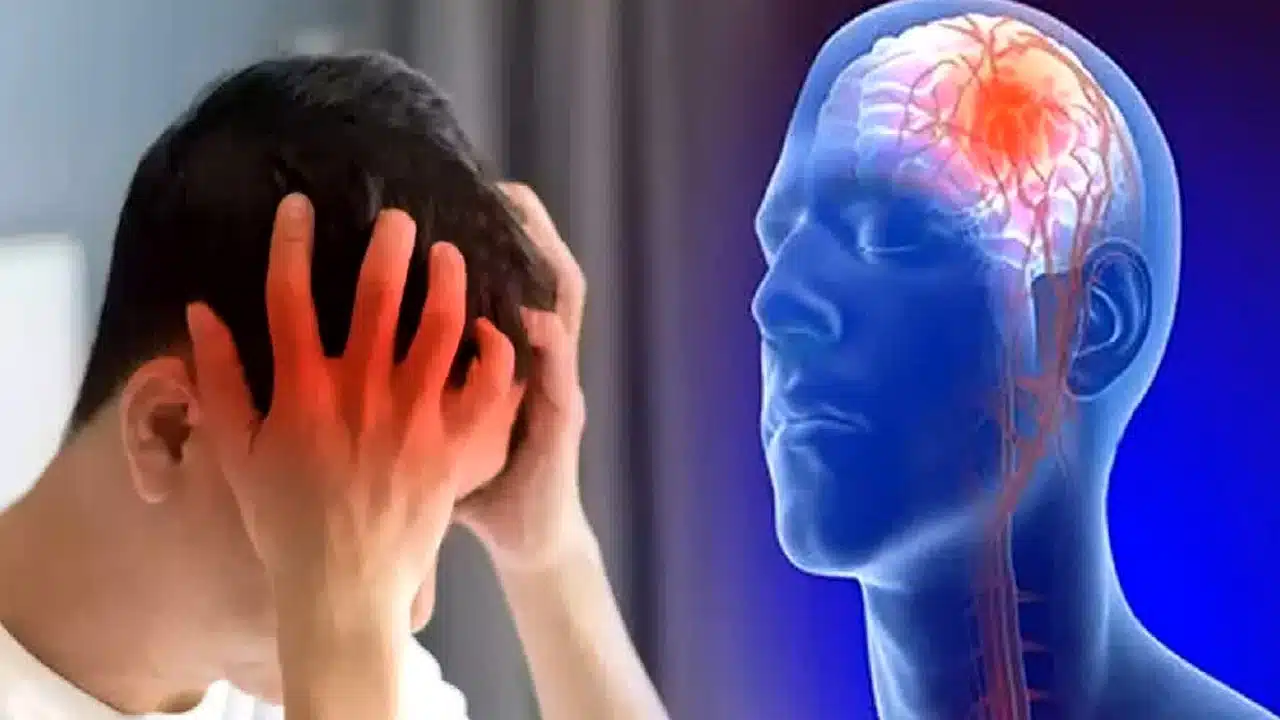 Brain Stroke : ఈ ల‌క్ష‌ణాలు మీలో క‌నిపిస్తున్నాయా.. అయితే ఇవి ప‌క్కా బ్రెయిన్ స్ట్రోక్ సంకేతాలే..!