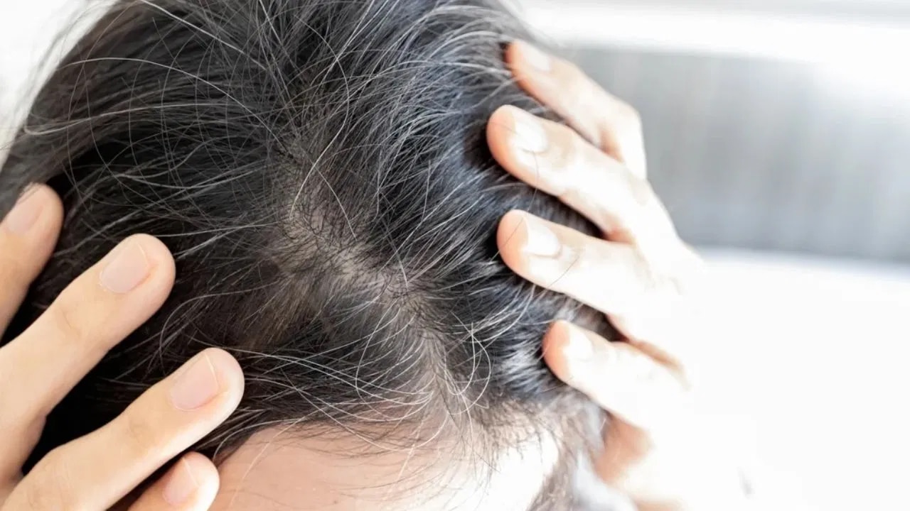 Hair Health Tips : అసలు తెల్ల జుట్టు ఎందుకు వస్తుంది… తెల్ల జుట్టుని,నల్లగా ఎలా మార్చాలి… సింపుల్ చిట్కా…?