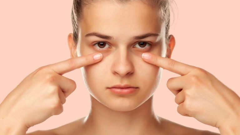 Home Remedies : మీ కళ్ళ కింద నల్లటి వలయాలు ఉన్నాయని చింతిస్తున్నారా… వీటితో మటుమాయం…?