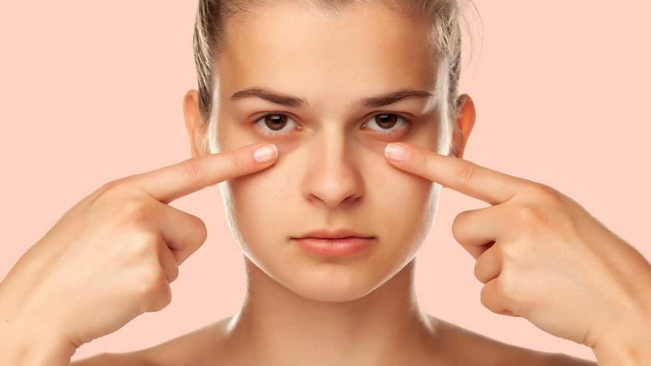 Home Remedies : మీ కళ్ళ కింద నల్లటి వలయాలు ఉన్నాయని చింతిస్తున్నారా… వీటితో మటుమాయం…?