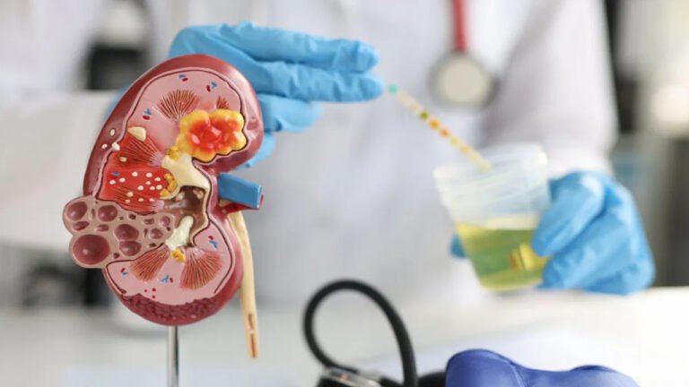 Kidneys Health : మీ కిడ్నీల పనితీరు బాగుండాలంటే ఇవి తినండి… క్రియాటిన్,యూరిక్ యాసిడ్ తగ్గుతాయి…?