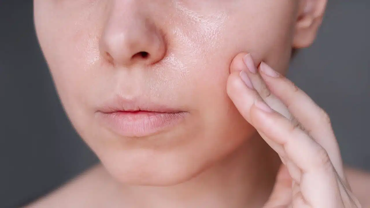 Oily Skin : మీ చర్మం జిడ్డు పట్టి ఉంటుందా.. ఈ టిప్స్ ఫాలో అవ్వండి.. మీల మీల మెరిసే తాజా చర్మం మీ సొంతం...?