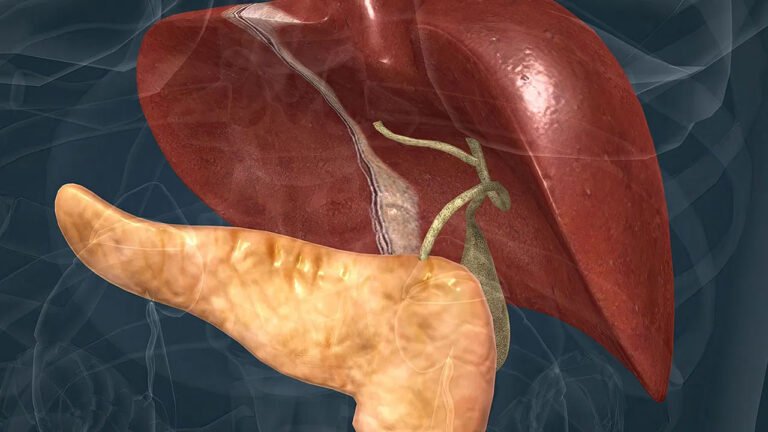 Fatty Liver | ఫ్యాటీ లివర్ సంకేతాలు.. ప్రాథమిక దశలో కనిపించని ముప్పు
