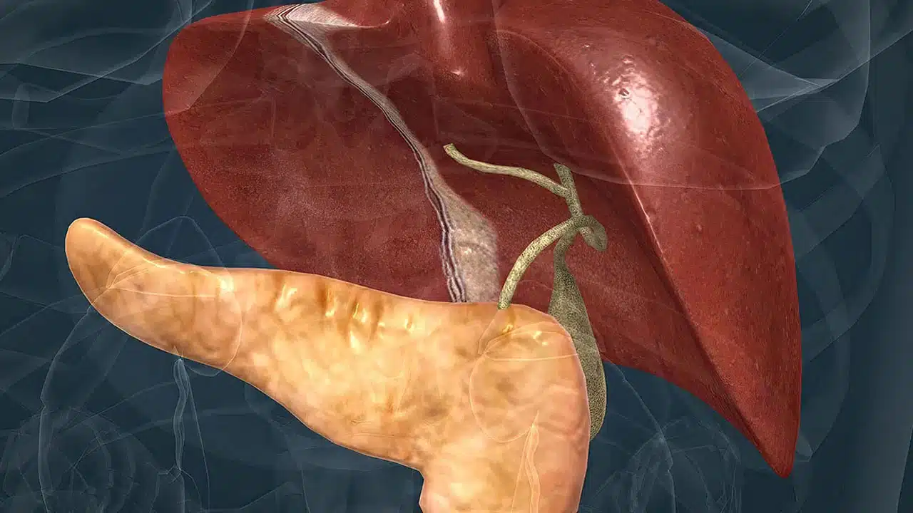 Fatty Liver | ఫ్యాటీ లివర్ సంకేతాలు.. ప్రాథమిక దశలో కనిపించని ముప్పు
