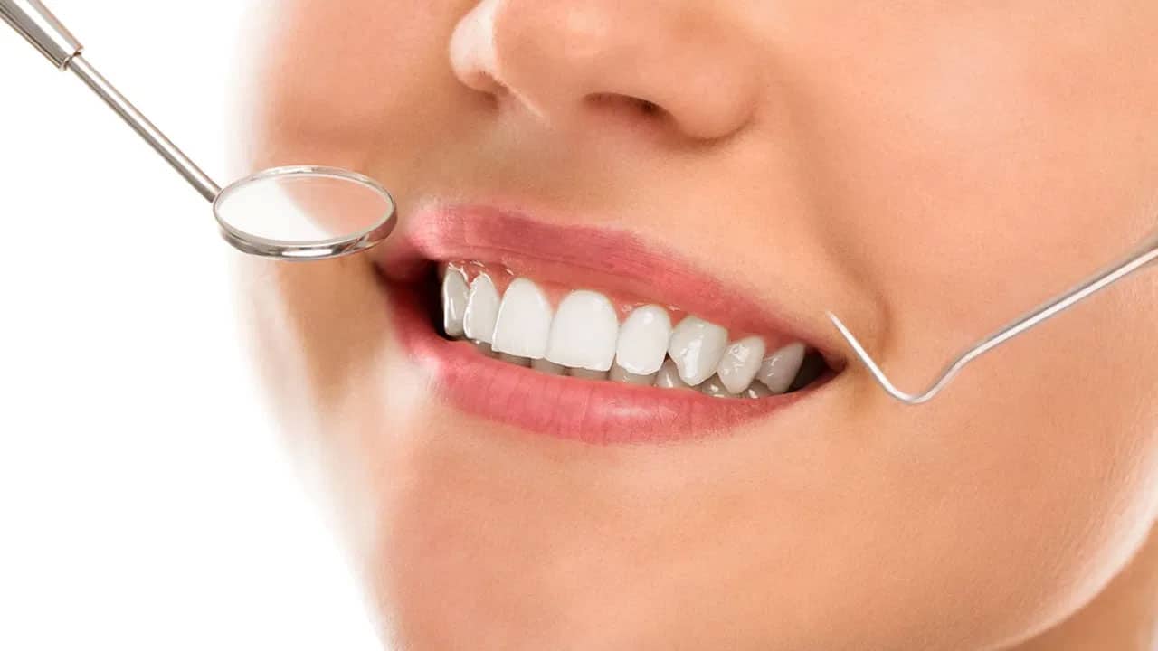 BRUSH | నిత్యం బ్ర‌ష్ చేస్తున్నా కూడా మీ దంతాలు పసుపు రంగులోకి మారుతున్నాయా?